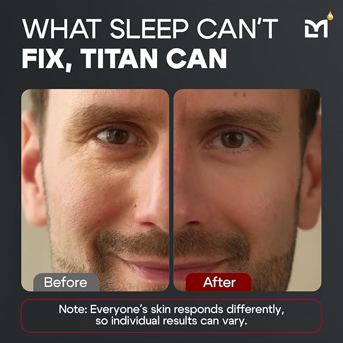 Titan Peptide Anti-Aging Under Eye Gel for Men – Reduce Appearance of Puffiness, Dark Circles, Eye Bags, & Sagging – DMAE, Niacinamide, Hyaluronic Acid, Peptides – All Skin Types – Unscented