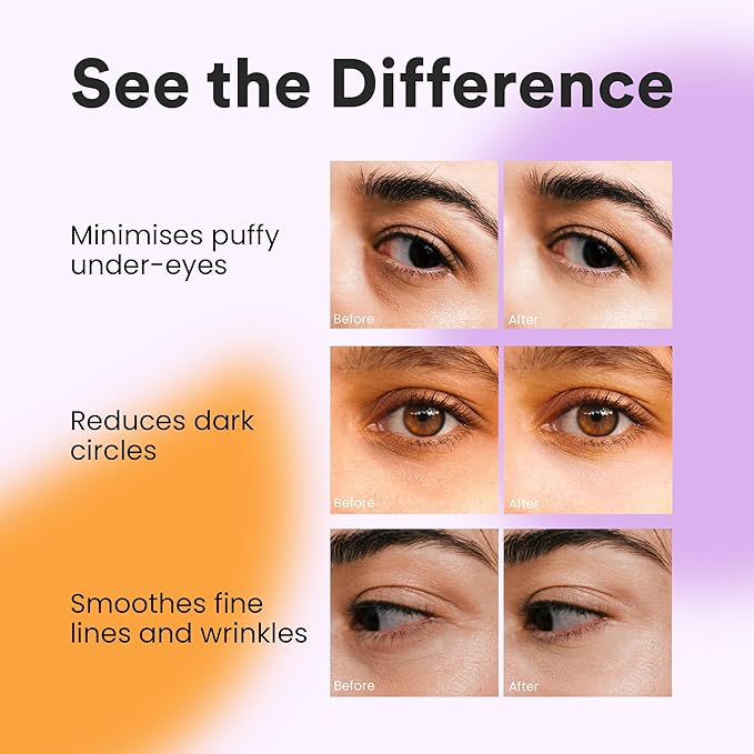 BLAQ Kakadu Plumpers Premium Under Eye Patches for Dark Circles and Puffiness. Australian Native Plum Extracts, Vegan and Cruelty-Free, 30-Pack