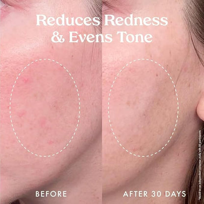 Kopari Star Bright Vitamin C Discoloration Correcting Serum with Kakadu Plum & Niacinamide, Brighter Complexion, Soothe & Diminish Dull Skin, 1.7oz