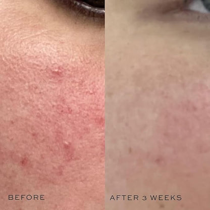 DIME Beauty Super Skin Toner, Alcohol-Free Witch Hazel Toner, Hydrating for Face with Aloe Vera and Cucumber Extract, 4 oz / 120 ml