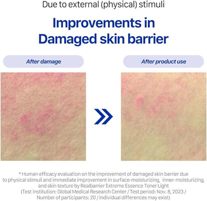 Real Barrier Extreme Essence Toner Light 6.76 Fl Oz | Hyaluronic Acid Panthenol Face Moisturizer for Sensitive Dry Skin | Soothing & Hydrating Moisturizing Toner for Face | Korean Skin Care