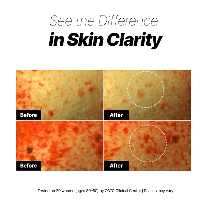 Glow Aurora Serum – Lightweight Korean Glow Drops for Face with Niacinamide, Hyaluronic Acid & Lutein, Face Glow Serum for a Dewy, Healthy-Looking Complexion, 1.01 fl oz / 30ml