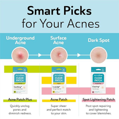 DERMA ANGEL Dark Spot Patches Blemish Patches with Hydrocolloid, TXA & CICA for Active Acne & Post-Inflammatory Dark Spots - Day and Night Use - UPGRADED (Post Acne - 96 Count - 1 Size)
