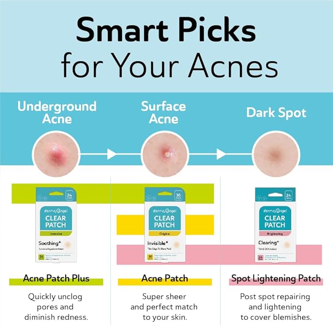 DERMA ANGEL Dark Spot Patches Blemish Patches with Hydrocolloid, TXA & CICA for Active Acne & Post-Inflammatory Dark Spots - Day and Night Use - UPGRADED (Post Acne - 132 Count - 2 Size)