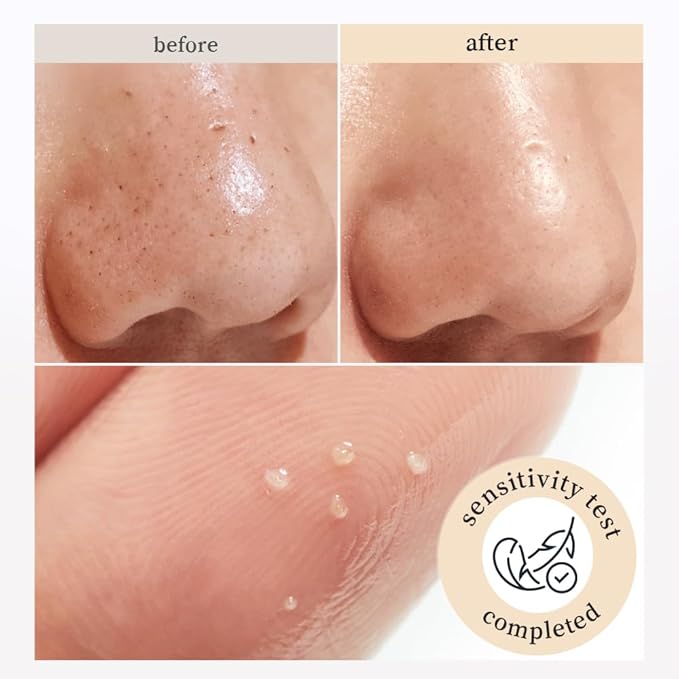 NOONI Korean Cleansing Oil – Snow Aqua 0 Rice Ceramide Barrier Care Cleansing Oil | Makeup Remover, Face Wash, Gentle Facial Cleanser, Pore Care, Korean Skin Care, Vegan, 6.76 Fl Oz