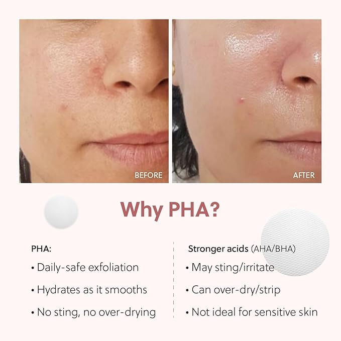 QUIA Dual-Action Toner Pads – Exfoliate and Hydrate Pores in One Step – Soothing PHA Formula for Sensitive Skin – Reduces Blackheads and Blemishes- 70 Textured Pads – Korean Skincare