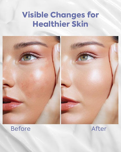 KOMFYMED Facial Moisturizing Lotion, Daily Moisturizer Face Cream with Sodium Hyaluronate & Microalgae Extract, Ultra-Lightweight, Hydrating Serum Face Lotion for All Skin Types - 2.7 fl.oz