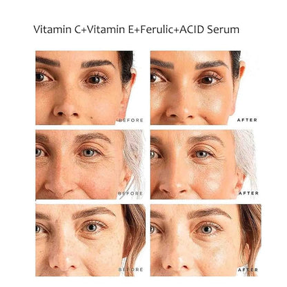 Vitamin C Face Serum Vitamin CE Serum with Ferulic Acid for Women Vitamin E and Ferulic Serum Skin Care - Vitamin C Serum for Face - Dark Spot Corrector, Anti Aging Face Care 1 Oz
