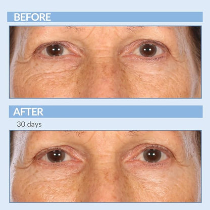 Vitamin A Force XR Retinol Serum Concentrate - Micro Exfoliate & Resurface for Radiant Skin - For Lines, Wrinkles - Pore Minimizer - Encapsulated Retinol for Anti-Aging - Serious Skincare - 1 Oz.