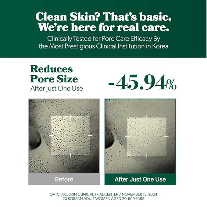 Omitted Fresh Lime Dewy & Pore Purifying Toner Pad - Pore Minimizer & Dead Skin Cells Exfoliator with LHA, Deep Hydration with Triple Hyaluronic Acid, Korean Skin Care, 70 pads, 5.41 fl. oz. (160ml)