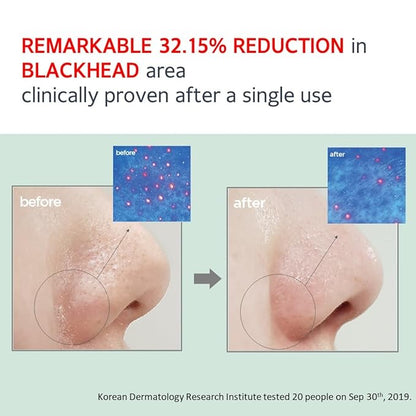 MAKE P:REM Safe Me. Relief Moisture Cleansing Oil, Deep Pore Cleansing Makeup Remover for Oily Skin, All Skin Types, Gentle Blackhead Remover, Korean Skin Care, 7.1 Fl Oz, 210ml