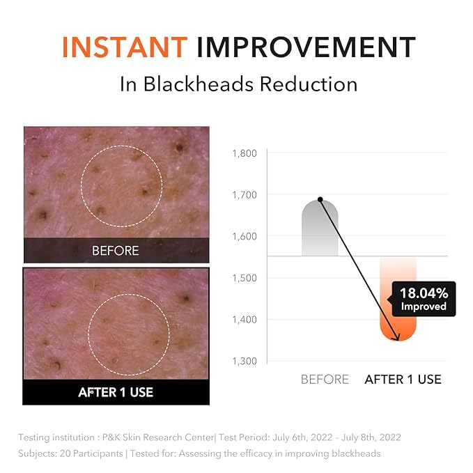 APRILSKIN Deep Clean & Glow Duo : Carrotene IPMP™ Hydromelt Cleansing Balm & Calendula Flower-Infused Peel Off Mask, Thorough Cleansing and Radiant Skin Care | Stocking Stuffers for Teen Girls