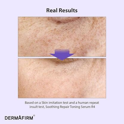 DERMAFIRM Bakuchiol Retinol Serum for Glass Skin with Niacinamide & Peptides | Daily Korean Skin Care for Sensitive Skin | Soothing Repair Toning Serum R4 for Glass Skin