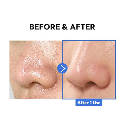 TIRTIR Hydro Boost Enzyme Cleansing Balm (4.05 Ounce (Pack of 1))