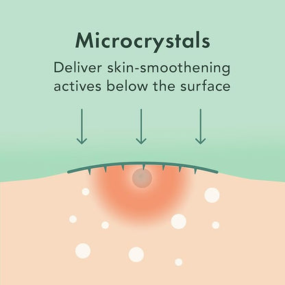 Rael Pimple Patches, Miracle Microcrystal Spot Cover - Hydrocolloid Acne Pimple Patch with Tea Tree Oil, Early Stage Zits and Blemish, Korean Skin Care (36 Count)