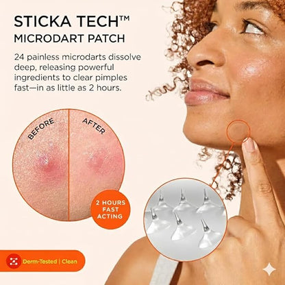ZitSticka Extra Strength Killa Acne Patches for Face - World's Most Potent Pimple Patch with Fast-Acting Microdarts - Starts Working within 2 Hours for Deep, Early-Stage Zits & Blemish - 20 Count