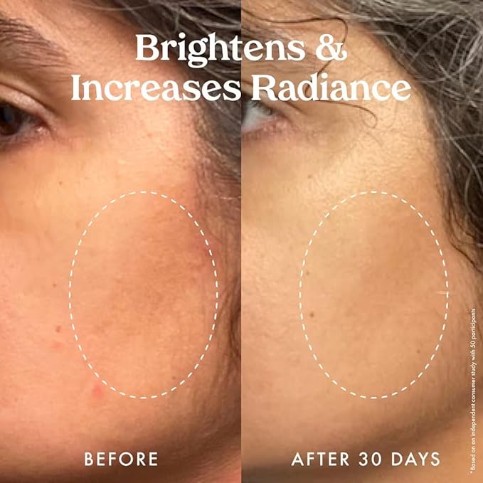 Kopari Star Bright Vitamin C Discoloration Correcting Serum with Kakadu Plum & Niacinamide, Brighter Complexion, Soothe & Diminish Dull Skin, 1.7oz