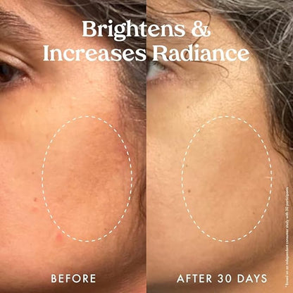 Kopari Star Bright Vitamin C Discoloration Correcting Serum with Kakadu Plum & Niacinamide, Brighter Complexion, Soothe & Diminish Dull Skin, 1.7oz