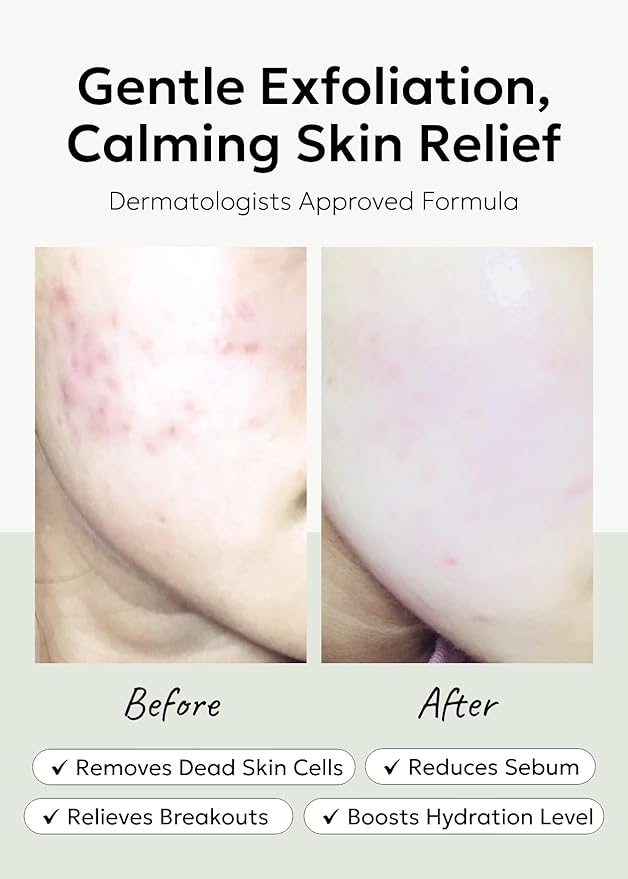 celimax Ji.Woo.Gae Heartleaf BHA Peeling Pad(60 pads) + Ji.Woo.Gae Cica BHA Blemish Toner Pad (60 Pads) Bundle