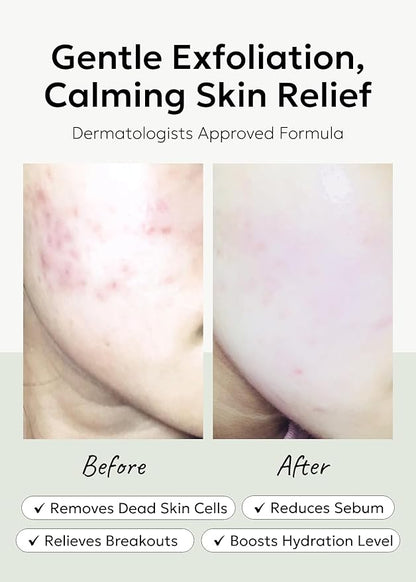 celimax Ji.Woo.Gae Heartleaf BHA Peeling Pad(60 pads) + Ji.Woo.Gae Cica BHA Blemish Toner Pad (60 Pads) Bundle