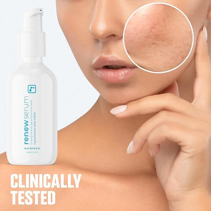BRIOTECH Renew Serum, Hypochlorous Acid Mineral Gel, Soften Fine Line Appearance, Smooth Skin for Face, Neck, Chest, Spot Corrector, Soothe Redness, Vegan, 2 fl oz (2 Pack)