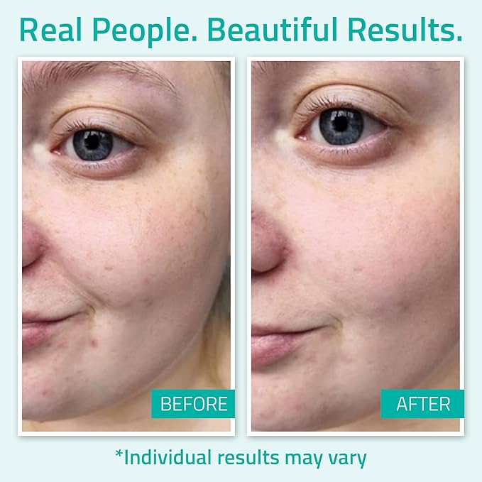 YEOUTH Pure Hyaluronic Acid Serum for Face 99% for Dry & Dull Skin, Hydrating Hyaluronic Acid Skincare Serum for Women & Men, For All Skin Types 2oz