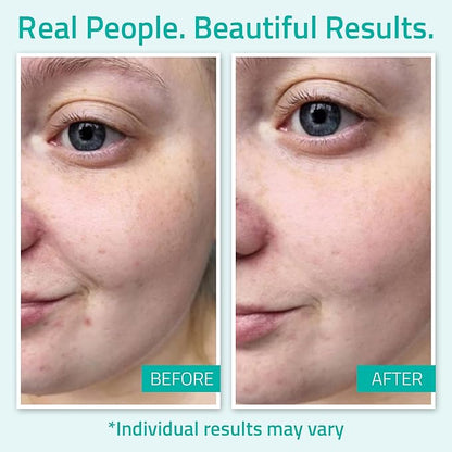 YEOUTH Pure Hyaluronic Acid Serum for Face 99% for Dry & Dull Skin, Hydrating Hyaluronic Acid Skincare Serum for Women & Men, For All Skin Types 2oz