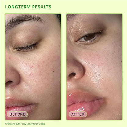 Experiment Buffer Jelly Intensive Barrier Treatment Oil – Ceramide, Squalane and Panthenol - Hydrating, Soothing and Strengthening, 1.0 FL OZ– Vegan Formula for Dry Skin Types