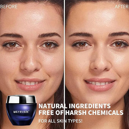 MEYRUEIS Anti-Aging Moisturizer Face Cream, NAD+, Moisturize Without Oil, Fast-Absorbing, Deeply Nourishing, For All Skin Types, 0.35 Fl Oz