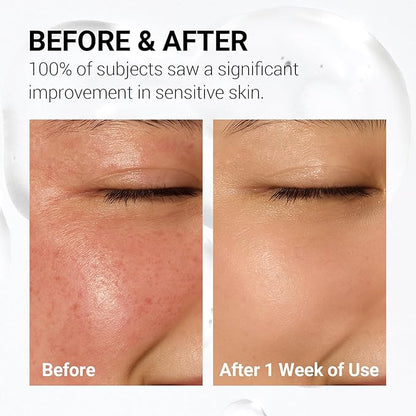 Soothing Calm Toner Pad, Daily Gentle Exfoliating & Hydrating Facial Pads for Intense Soothing Care, Heartleaf Extract and CICA for Sensitive Skin Safe, Korean Skincare (60 Pads)