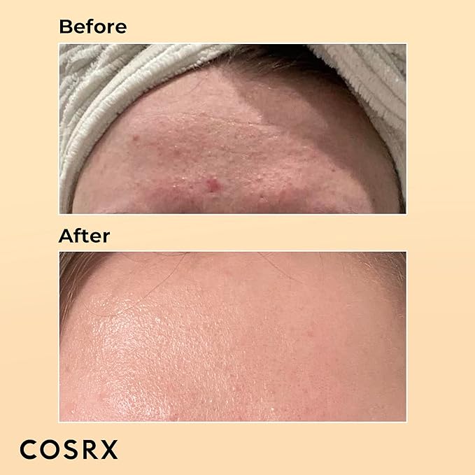 COSRX Skin Cycling Routine - Snail Mucin 96% Essence + Retinol 0.5 Oil, Recovery Set for Face and Neck, Fine Lines Spot Treatment, Repair Oil for Face