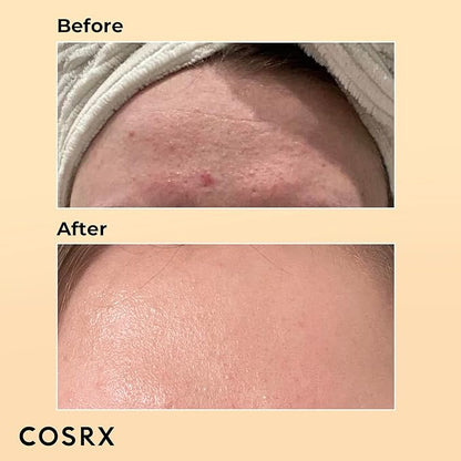 COSRX Skin Cycling Routine - Snail Mucin 96% Essence + Retinol 0.5 Oil, Recovery Set for Face and Neck, Fine Lines Spot Treatment, Repair Oil for Face
