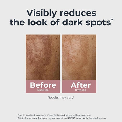 Eucerin Radiant Tone Dual Serum Dark Spot Corrector, Dark Spot Serum with Thiamidol and Hyaluronic Acid, Helps Visibly Reduce the Look of Persistent Dark Spots, 1 Fl Oz Bottle