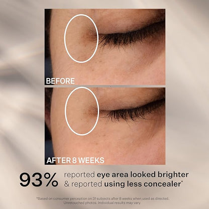 StriVectin Super C Dark Circle Brightening Eye Serum, 0.5 oz