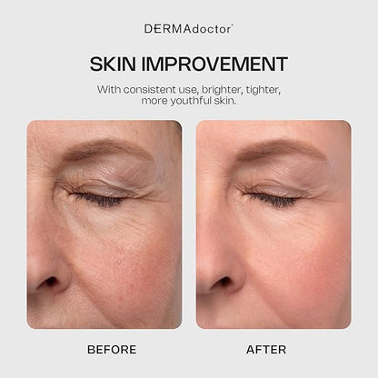 DERMAdoctor Glycolic Acid Exfoliating Face Wash - Anti-Aging, Antioxidant Enhanced Glycolic Acid Toner Facial Exfoliator to Address Fine Lines, Wrinkles, Dullness, Uneven Skin Tone, and Enlarged Pores