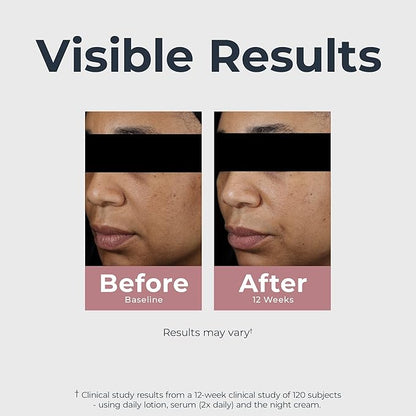 Eucerin Radiant Tone Dual Serum Dark Spot Corrector, Dark Spot Serum with Thiamidol and Hyaluronic Acid, Helps Visibly Reduce the Look of Persistent Dark Spots, 1 Fl Oz Bottle