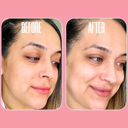 Glycolic Acid Pads with Vitamin C - Toner Pads for Face Cleansing With Tea Tree Oil - Exfoliating Pads with 20% AHA & Vitamins E, B3, B5 - Facial Peel Resurfacing Pads, Glycolic Acid Peel (50)