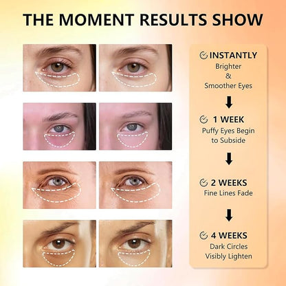 Under Eye Patches with Vitamin C & Caffeine 30 Pairs for Dark Circles, Fine Lines and Puffiness, with Niacinamide Hydra-Gel Collagen, Skin Care for Men & Women - 2 PACK