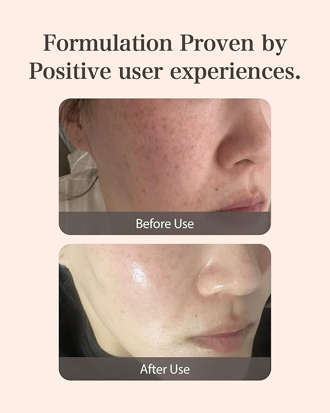 Mastina Mastic Ampoule - Facial Serum for Glass&Radiant Skin. White Mastic Complex 63% + Tranexamic Acid 2% + Niacinamide 5% Acid, Korean Skin Care (Dropper, 0.5fl oz)