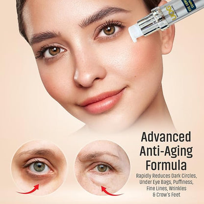 UOG (United One) Eye Serum Complex – Rapid Reduction Eye Serum for Dark Circles, Puffiness, Wrinkles & Crow’s Feet | Anti-Aging Formula for Firm, Youthful Eyes | Hydrates & Smooths (20ml / 0.7oz)