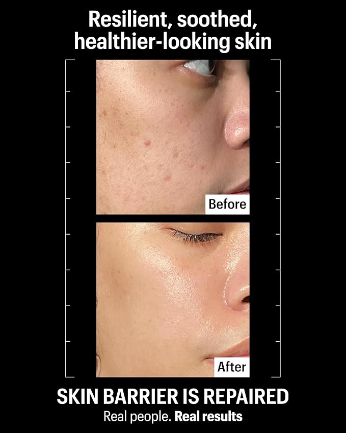 Allies of Skin Molecular Barrier Repair Cream Balm | Deeply Hydrating Face Moisturizer with Ceramides & Squalane | Daily Treatment to Soothe Irritated Skin | For Post-Procedure and Dry Skin | 1 fl oz