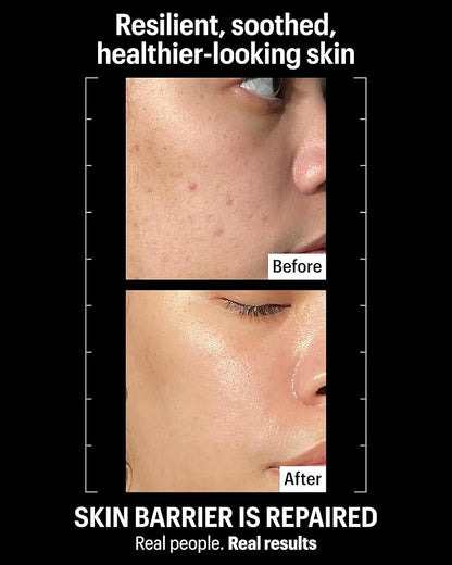 Allies of Skin Molecular Barrier Repair Cream Balm | Deeply Hydrating Face Moisturizer with Ceramides & Squalane | Daily Treatment to Soothe Irritated Skin | For Post-Procedure and Dry Skin | 1 fl oz