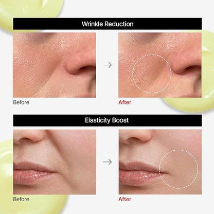 Dr.Different VITALIFT-A Forte Retinal 0.1%, Intensive Anti-Aging Cream for Wrinkle Reduction, Skin Elasticity, Lifting, Firming with Vita A, K-Skincare made by Korean Dermatologist. 0.7oz