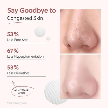 QUIA Dual-Action Toner Pads – Exfoliate and Hydrate Pores in One Step – Soothing PHA Formula for Sensitive Skin – Reduces Blackheads and Blemishes- 70 Textured Pads – Korean Skincare