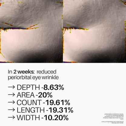 Superface Volupeptinol™ Radiance Serum – Anti-Aging Brightening Face Serum for Women & Men with Volufiline, Peptides & Retinal, Protects Skin Barrier, 35ml / 1.18oz
