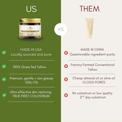 100% Grass Fed Tallow Balm with Colostrum & Emu Oil - Handmade Whipped Beef Tallow for Face and Body, Sensitive Skin Tallow Moisturizer made with True First Colostrum