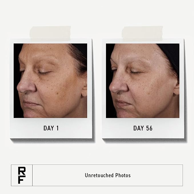 Rodan + Fields Reverse Deep Exfoliating Cleanser | 125 mL | Daily Facial Scrub with Glycolic Acid and AHAs