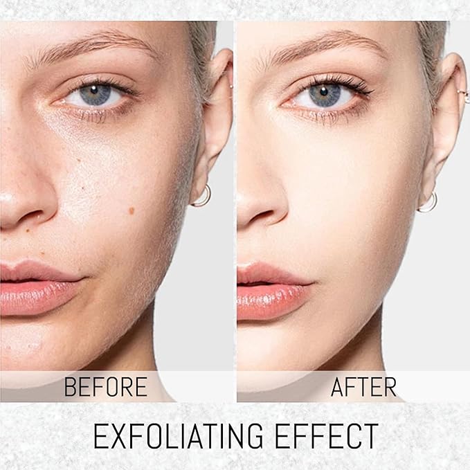 2PCS Rice Exfoliating Ampoule Set – Black & White Rice Dual Brightening Treatment | Gentle Enzyme Peel + Hydration Boost for Glowing Skin | Pore Refining & Dark Spot Care (1)