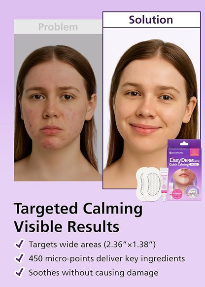 EasyDerm Quick Calming Magnesium Patches WIDE – 2 Packs / 4 XL Patches Total, Extra-Large Hydrocolloid Patch for Severe Acne, Soothing & Waterproof, Amazon Exclusive