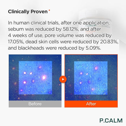 P.CALM Barrier Cycle Toner Pad Refill Pack – 120 Pads (60 + 60) with Centella Asiatica & Papaya Extract for Soothing, Moisturizing & Exfoliating, Korean Vegan Facial Toners Pads for Sensitive Skin